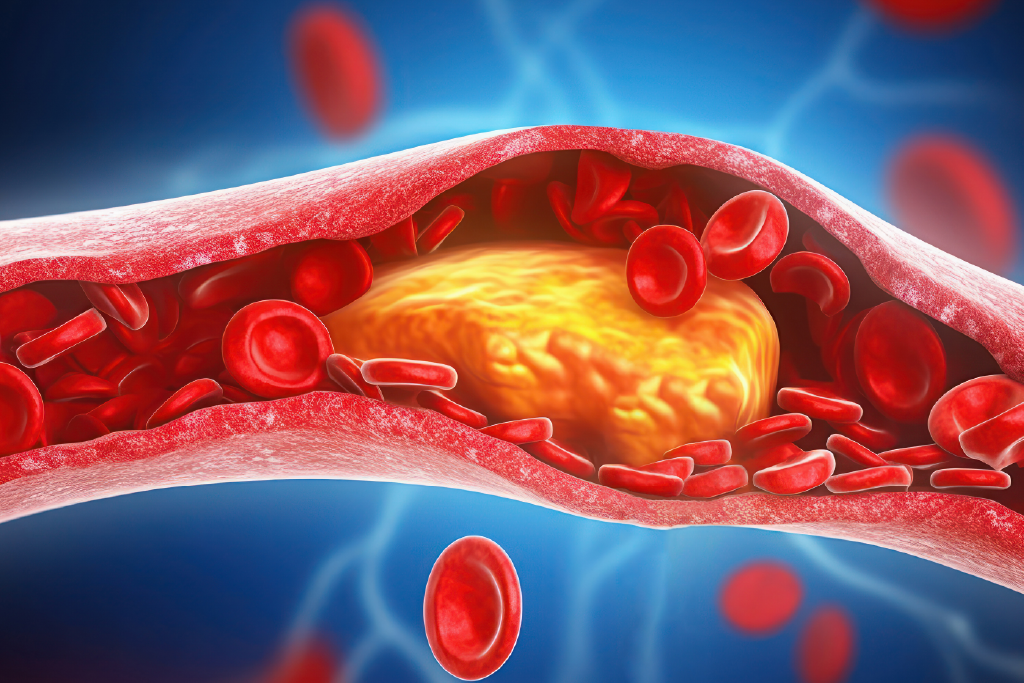 An image depicting the natural treatment of high blood pressure and cholesterol through lifestyle changes and dietary adjustments.