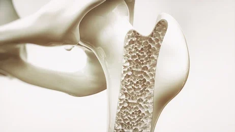 An informative visual illustrating the impact of alkaline water on bone health, highlighting its potential benefits in preventing bone loss and enhancing bone density.
